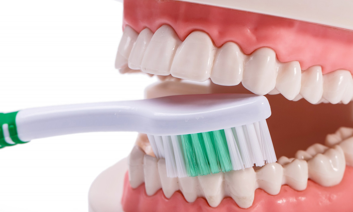 Vì sao trụ Implant có thể bị đào thải? Dấu hiệu cảnh báo sớm